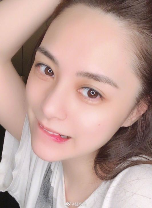 阿嬌頭部表面一層已縫66針什么情況?在酒店房間究竟發(fā)生了什么?