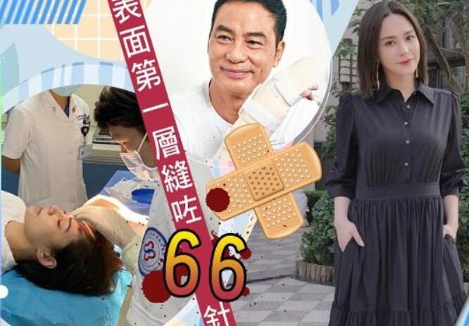 阿嬌頭部表面一層已縫66針是怎么回事?什么情況?終于真相了,原來是這樣!