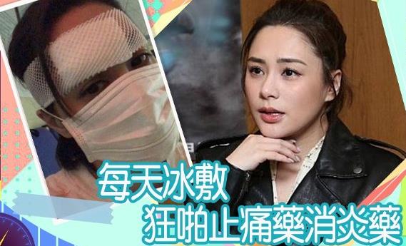 阿嬌