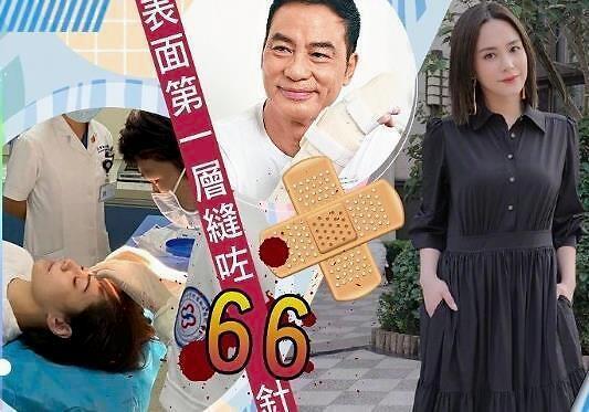 阿嬌酒店意外受傷觸目驚心，二次手術(shù)表面重縫66針