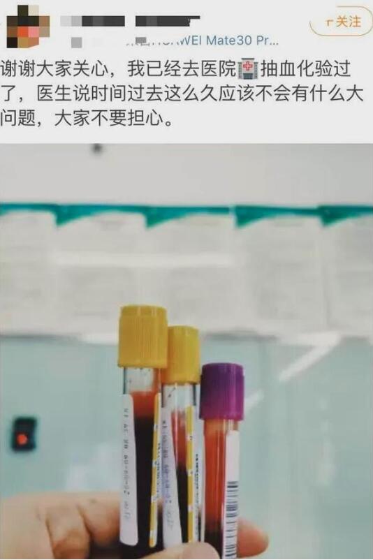 窒息!女子點外賣里面竟有只癩蛤蟆是怎么回事?具體什么情況?