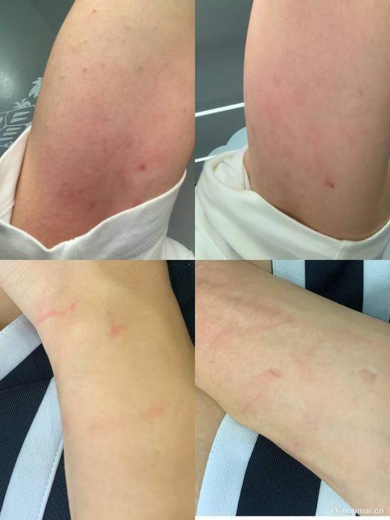 虎牙員工自曝被HR抬出公司，到底發生了什么？