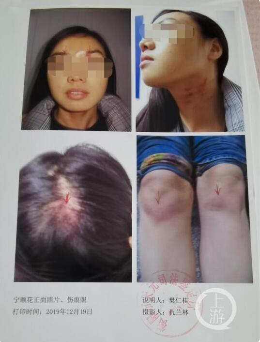 女子5年4次起訴離婚均被駁回 女子遭家暴父親被毆打 被駁回的理由是什么？
