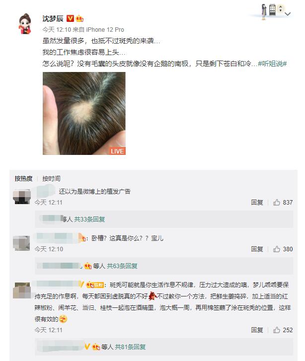 沈夢(mèng)辰因過度焦慮斑禿 曬頭頂照震驚網(wǎng)友