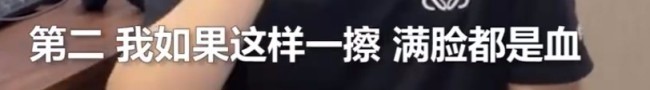 敬業！主持人回應流鼻血仍淡定播新聞 事件回顧