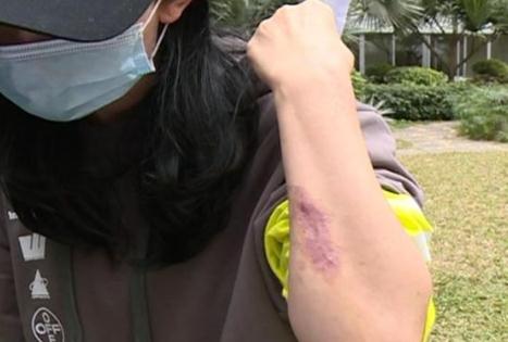 女子23萬整出四個胸 2020年如何進行醫療美容糾紛的維權?